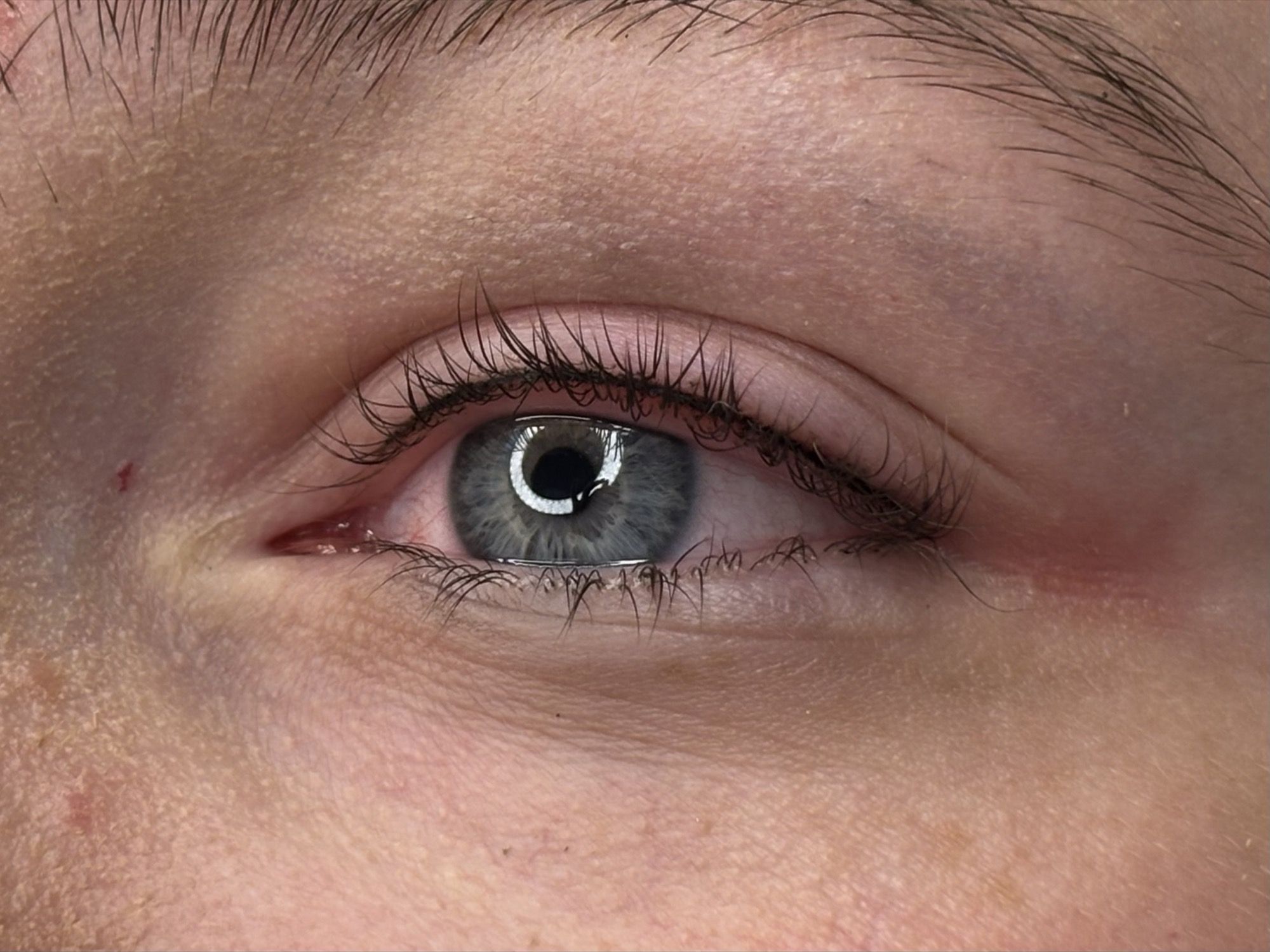 Wimpernkranzverdichtung Beispiel 2